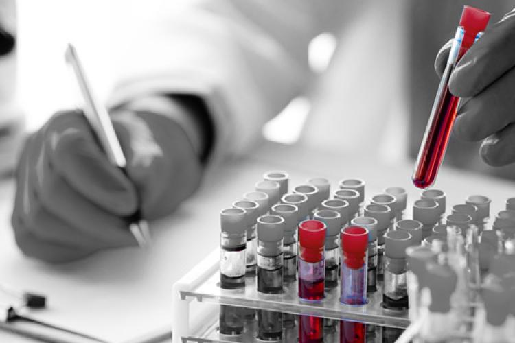 Multi-Cancer Early Detection: Insurance questions amid new evidence