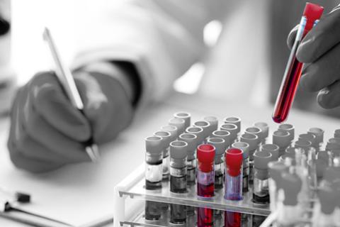 Multi-Cancer Early Detection: Insurance questions amid new evidence